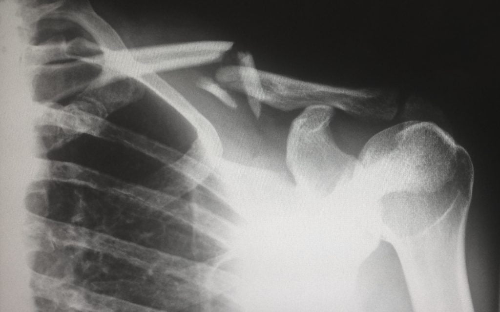 Fractured or injured something and need help with cleaning and household chores - contact MEIDE.SG today